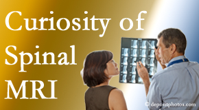 Montreal MRIs for spinal stenosis may be revealing…or puzzling.