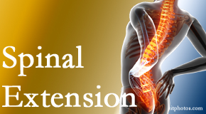 Dr. Hoang's Chiropractic Clinic knows the role of extension in spinal motion, its necessity, its benefits and potential harmful effects. 