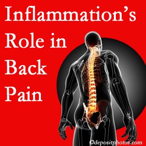 The role of inflammation in Montreal back pain is real. Chiropractic care can manage it.
