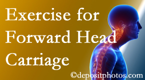 Montreal chiropractic treatment of forward head carriage is two-fold: manipulation and exercise.