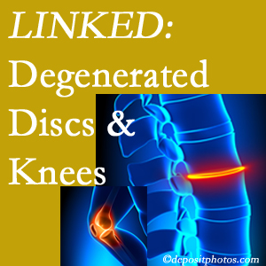 Degenerated discs and degenerated knees are not such strange bedfellows. They are seen to be related. Montreal patients with a loss of disc height due to disc degeneration often also have knee pain related to degeneration.  