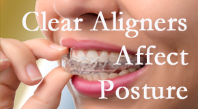 Clear aligners influence posture which Montreal chiropractic helps.