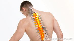 Montreal thoracic spine pain image 