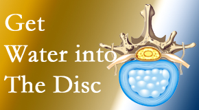 Dr. Hoang's Chiropractic Clinic uses spinal manipulation and exercise to boost the diffusion of water into the disc which helps the health of the disc.