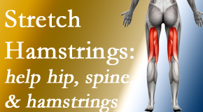 Dr. Hoang's Chiropractic Clinic encourages back pain patients to stretch hamstrings for length, range of motion and flexibility to support the spine.