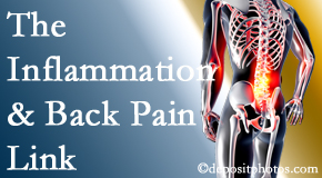Dr. Hoang's Chiropractic Clinic tackles the inflammatory process that accompanies back pain as well as the pain itself.