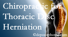 Dr. Hoang's Chiropractic Clinic diagnoses and treats thoracic disc herniation pain and relieves its symptoms like unexplained abdominal pain or other gastrointestinal issues. 