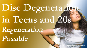 Dr. Hoang's Chiropractic Clinic manages back pain due to disc degeneration in younger people in their teens and 20s. 