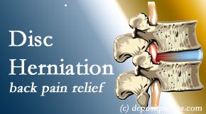 Dr. Hoang's Chiropractic Clinic uses non-surgical treatment for relief of disc herniation related back pain. 