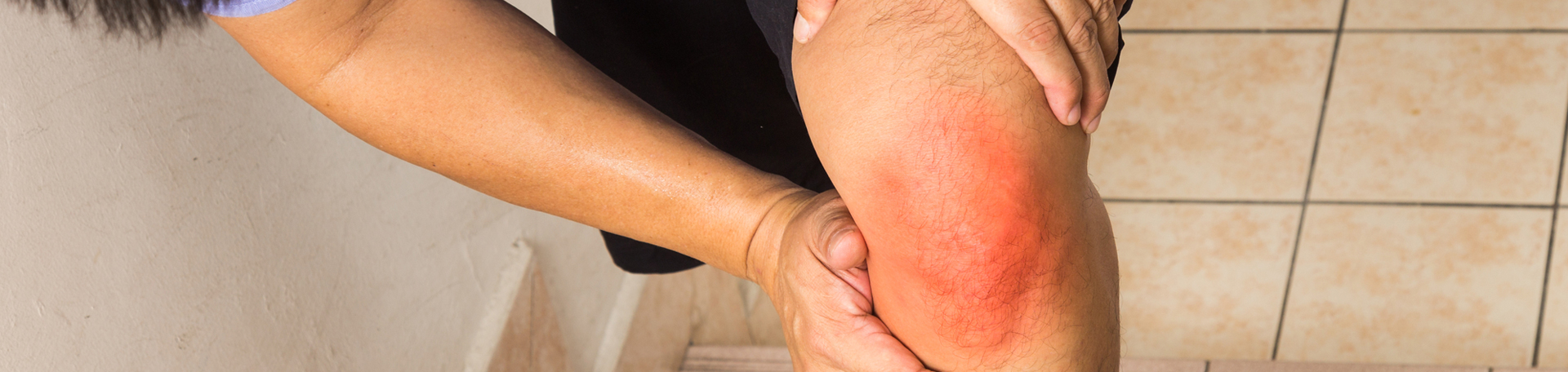 Montreal knee pain, osteoarthritis