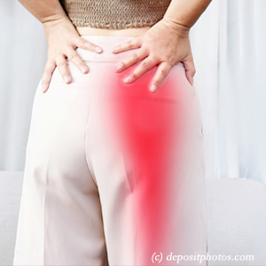 image of Montreal leg pain, sciatica, lumbar radiculopathy