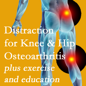 A chiropractic treatment plan for Montreal knee pain and hip pain due to osteoarthritis: education, exercise, distraction.