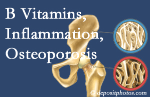 Montreal chiropractic care of osteoporosis usually comes with nutritional tips like b vitamins for inflammation reduction and for prevention.