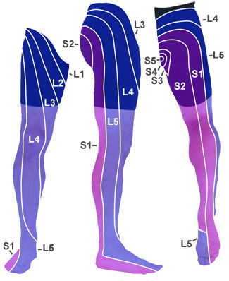image of leg pain diagram