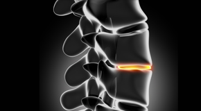 Montreal chiropractic nutrition with vitamin D and quercitrin