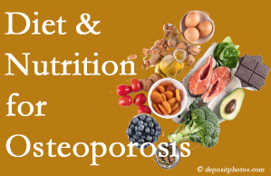 Montreal osteoporosis prevention tips from your chiropractor include improved diet and nutrition and reduced sodium, bad fats, and sugar intake. 