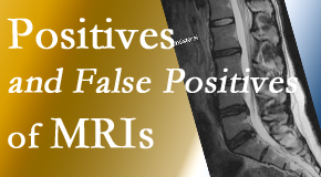 Dr. Hoang's Chiropractic Clinic carefully decides when and if MRI images are needed to guide the Montreal chiropractic treatment plan. 